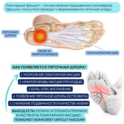 Купить 12 шт. пяточная шпора, пластырь для облегчения боли, наклейка для  ухода за ногами прижигания | Joom