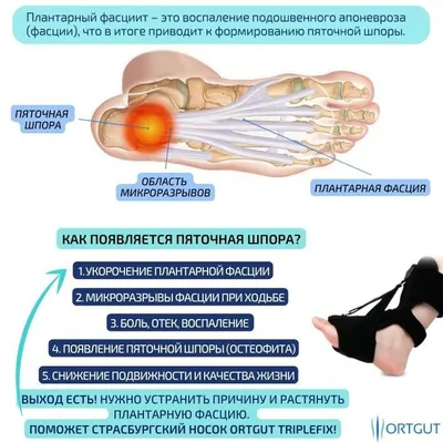 Лечебная гимнастика при пяточной шпоре в домашних условиях: упражнения и  техники лечебной физкультуры (ЛФК) для стоп