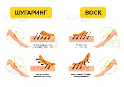 Шугаринг. Сахарная депиляция. Сторис | Сахарная депиляция, Восковая  депиляция ног, Восковая депиляция