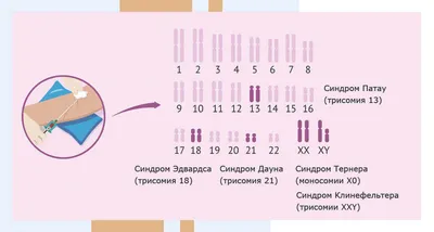 Синдром Шерешевского-Тернера — Марина Алташина на TenChat.ru