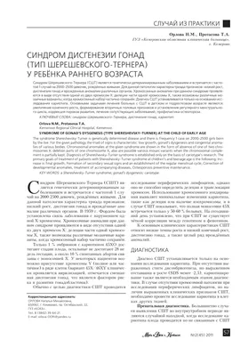 Что такое синдром Шерешевского-Тернера