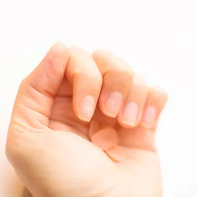 Изображение рук с слоящимися ногтями в разных размерах