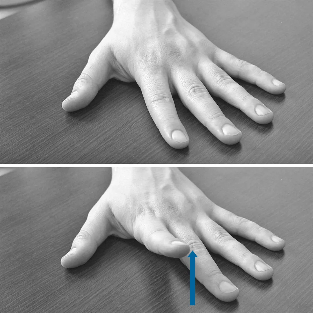 Как восстановить палец после. ЛФК при переломе пальца руки. ЛФК для разработки пальцев рук. Разработка пальцев после перелома. Гимнастика после перелома пальца руки.