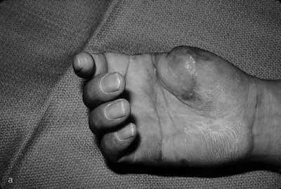 Сломанный палец на руке: фото в высоком разрешении