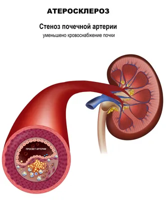 Почему видны вены на руках