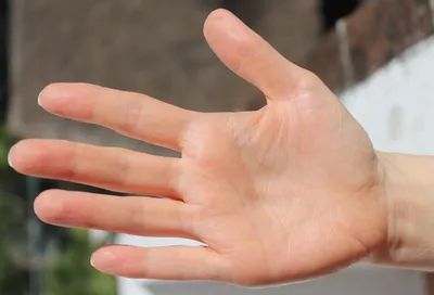 Стержневая мозоль на пальце руки: качественное изображение