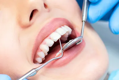 Как мотивировать стоматологов и администраторов продавать комплексное  лечение? | Dentist+