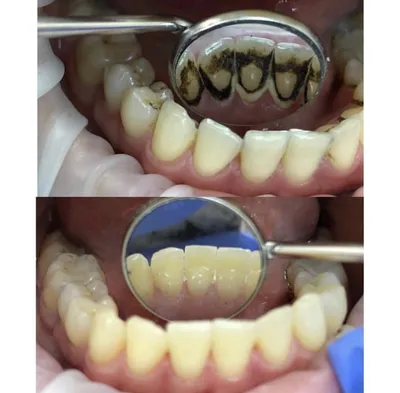 Чем занимается врач стоматолог-терапевт? Отличия от обычного стоматолога