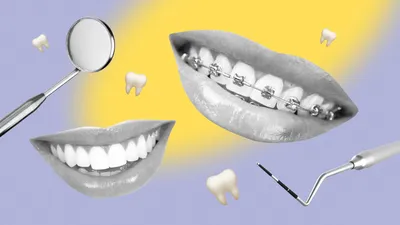 Анестезия в стоматологии - виды, особенности