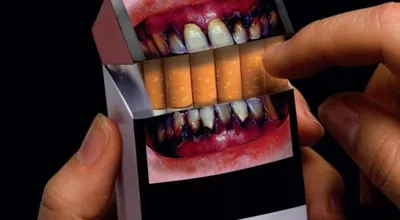 Страшные картинки» на пачках сигарет не влияют на сокращение курильщиков в  Казахстане