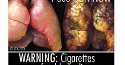 Надписи и картинки: помогают ли бороться с курением страшные упаковки  сигарет | Национальные проекты России