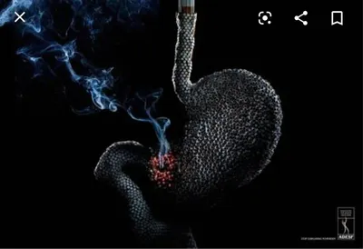 ВРЕД КУРЕНИЯ | Курить Больше Не Захочется [ВЫ УБИВАЕТЕ ДЕТЕЙ] - YouTube