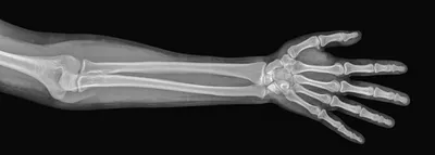 Строение руки человека: фото с подписями мышц и сухожилий