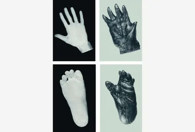 Изображение руки человека: с примерами различных типов кожных инфекций в формате PNG