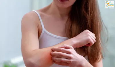 Сыпь и зуд на руках: изображения для лечения аллергии