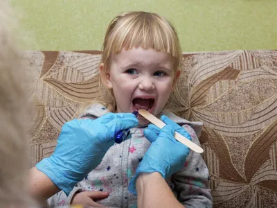 Сыпь на руках и ногах у ребенка: фото для анализа