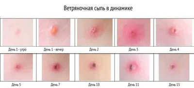 Фото сыпи на руках: определение причины