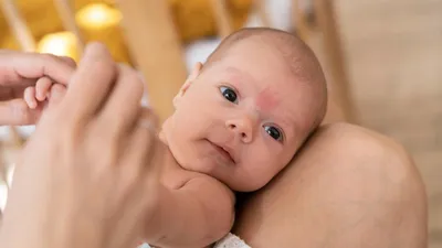 Картинка сыпи на руках младенца в высоком разрешении