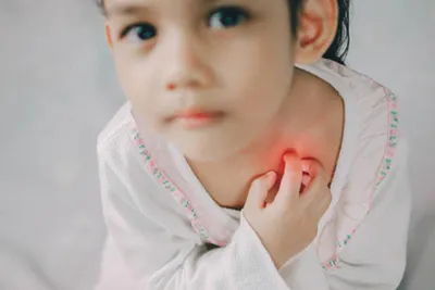 Сыпь на руках у ребенка: фото с эффектом двойной экспозиции