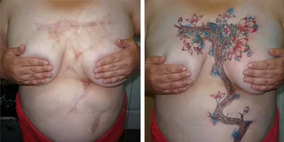 Татуировка рубец: все, что нужно знать о процедуре - tattopic.ru