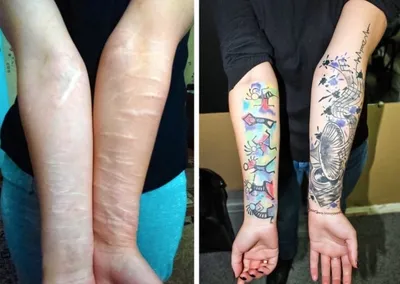 Изображение татуировки на руке с шрамами в низком разрешении