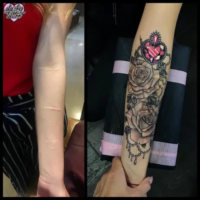 Изображение татуировки на шрамах на руке для скачивания в формате WebP