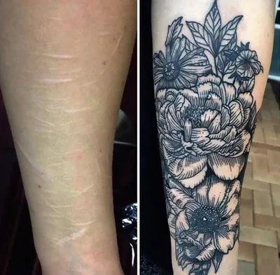 Картинка татуировки на руке с шрамами для твоего тату-марафона