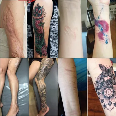 Фото татуировки на шрамах на руке в высоком разрешении
