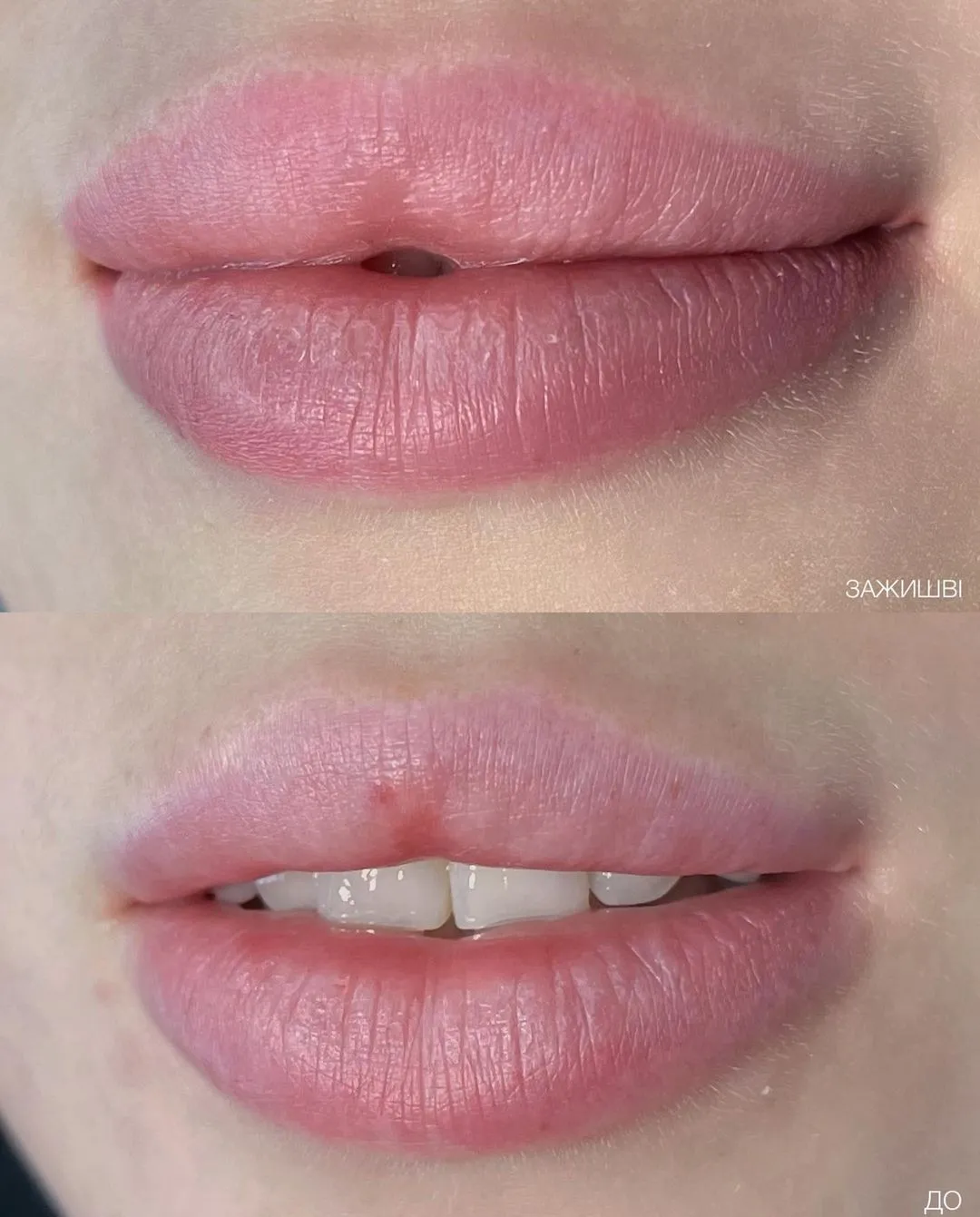 Акварельные губы до и после. Акварельные губы. Акварельные губы фото. Акварельные губы фото до и после.