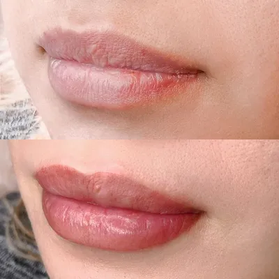 Фотография татуажа губ до и после заживления с использованием оформления в виде рта