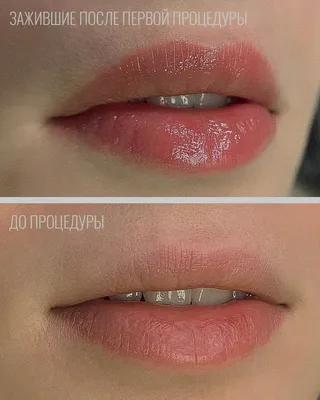Татуаж губ: до и после заживления (фото)