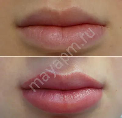Татуаж губ: фотографии перед и после процедуры