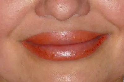 Фото татуажа губ, который неудачно получился