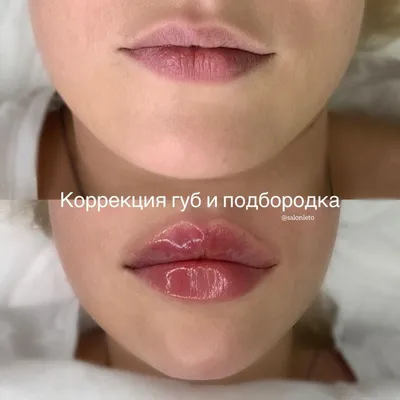 Фотографии заживления татуажа губ и результат