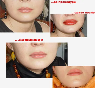 Татуаж губ с растушевкой: фото-отчет о процедуре и результате