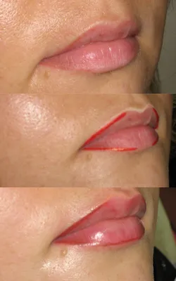 До и после татуажа губ с растушевкой на фото: выбирайте свой идеальный образ