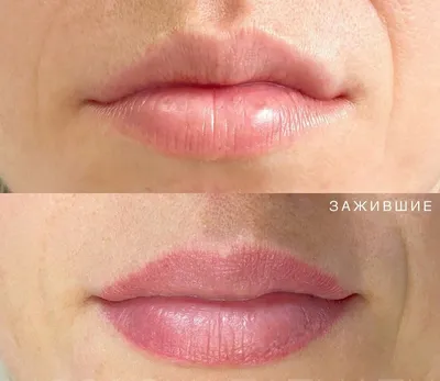 Татуаж губ заживление: фото с разной интенсивностью цвета