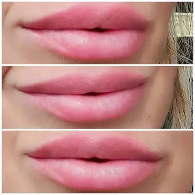 Как сохранить красоту губ: Фото