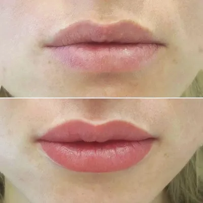 Как сохранить красоту губ: Фото в высоком разрешении