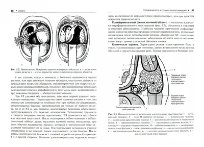 Медицинский центр \"Целитель\" - Постоянно болит горло — знакомая ситуация?  По статистике более 10% взрослых и 15% детей имеют диагноз «хронический  тонзиллит»🤒 Заболевание характеризуется воспалением глоточных и нёбных  миндалин и возникает после