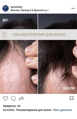 INST: TORI DM #уходзакожей | TikTok