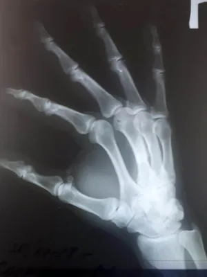 Изображение трещины на кисти руки в формате PNG