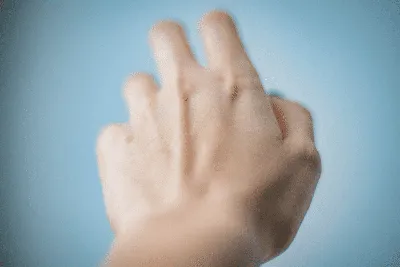 Трещины на пальцах рук: фото с эффектом зеркала
