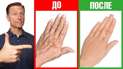 Изображения трещин на пальцах рук: скачайте бесплатно