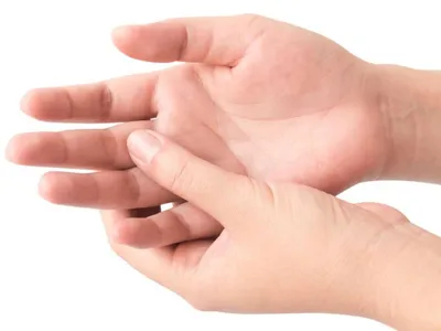 Фотография рук с трещинами на коже