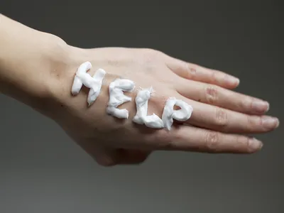 Фотография рук с проявлениями аллергии
