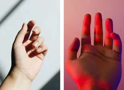 Изображение рук с проявлениями дерматита и зудом