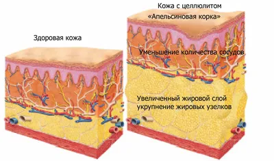 Фото рук с целлюлитом: загрузка в JPG формате