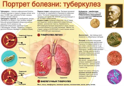 ПРОФИЛАКТИКА ТУБЕРКУЛЕЗА У ДЕТЕЙ | ГБУЗ Республики Мордовия «Детская  поликлиника № 3»