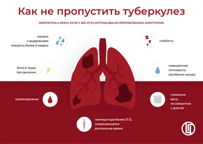 Да! Мы можем ликвидировать Туберкулез!» | Организация Объединенных Наций в  Узбекистане